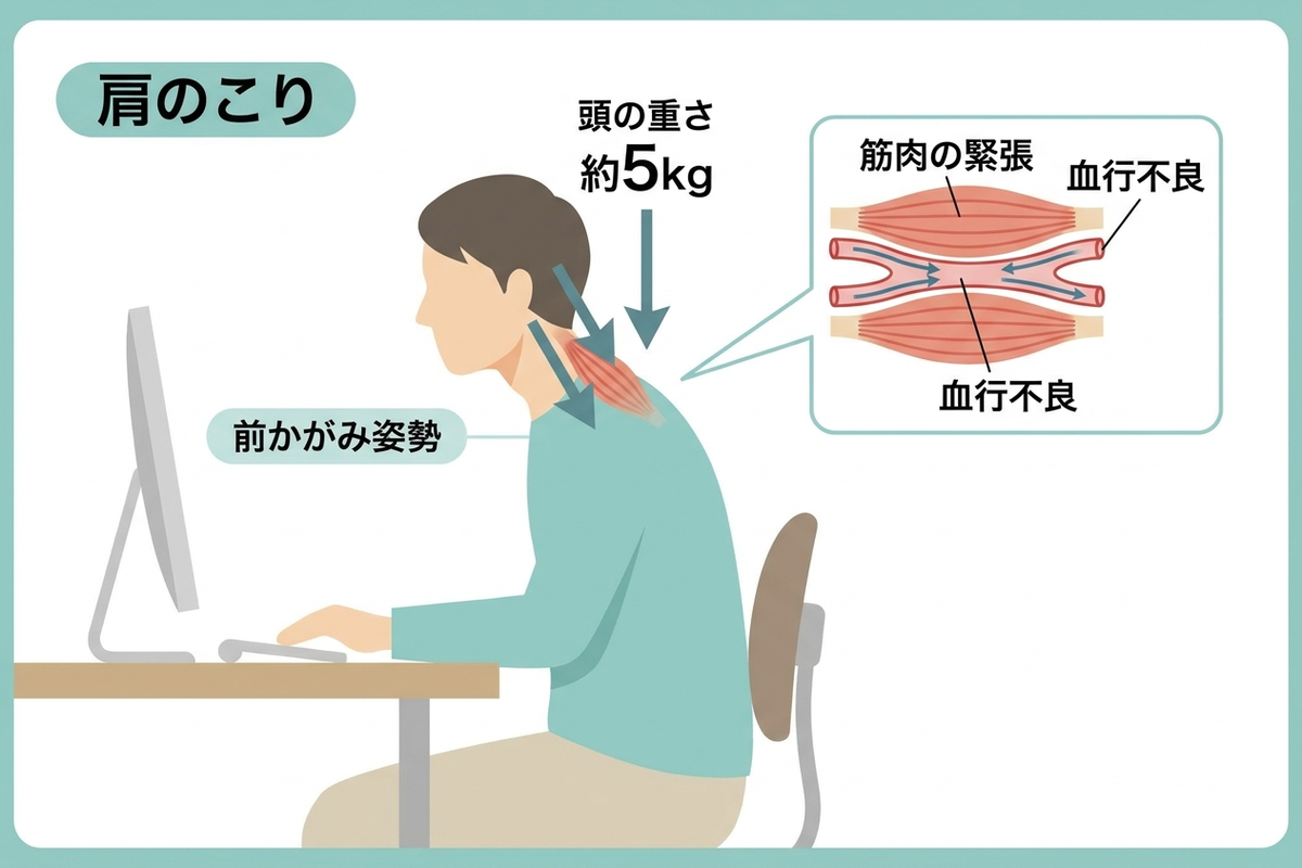 肩こりが起きる仕組みの図解