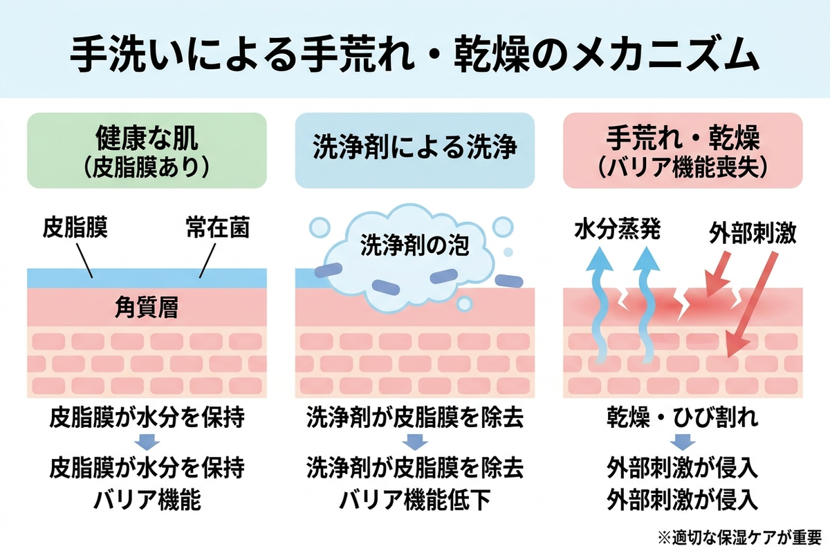 手洗いによる手荒れ・乾燥のメカニズム図解
