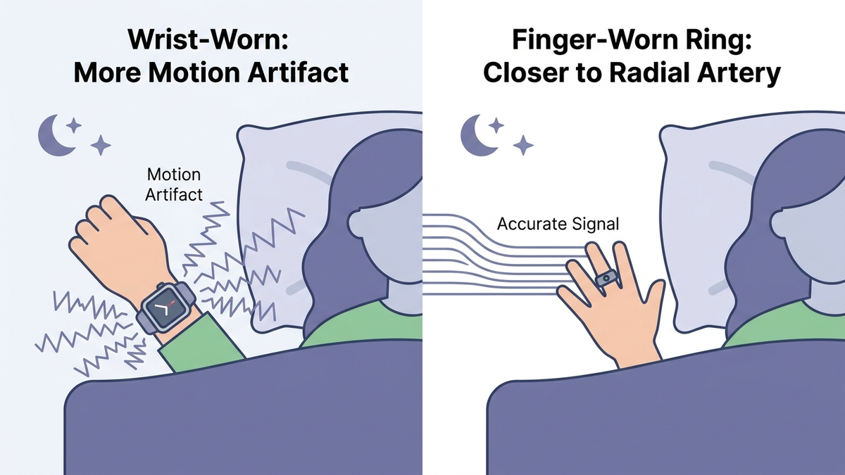 Infographic comparing wrist-worn smartwatch sleep-tracking accuracy against finger-worn smart ring accuracy, showing motion-artifact difference
