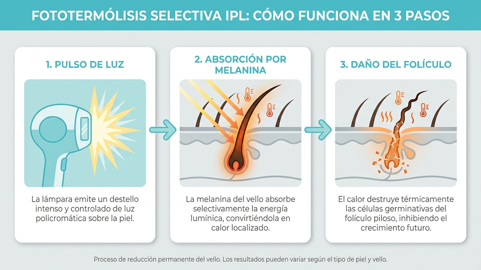 Cómo funciona la tecnología IPL: fototermólisis selectiva paso a paso